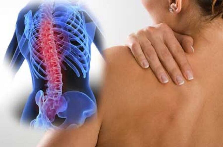 ด้วย osteochondrosis ความเจ็บปวดสามารถแผ่กระจายไปยังส่วนต่าง ๆ ของร่างกาย