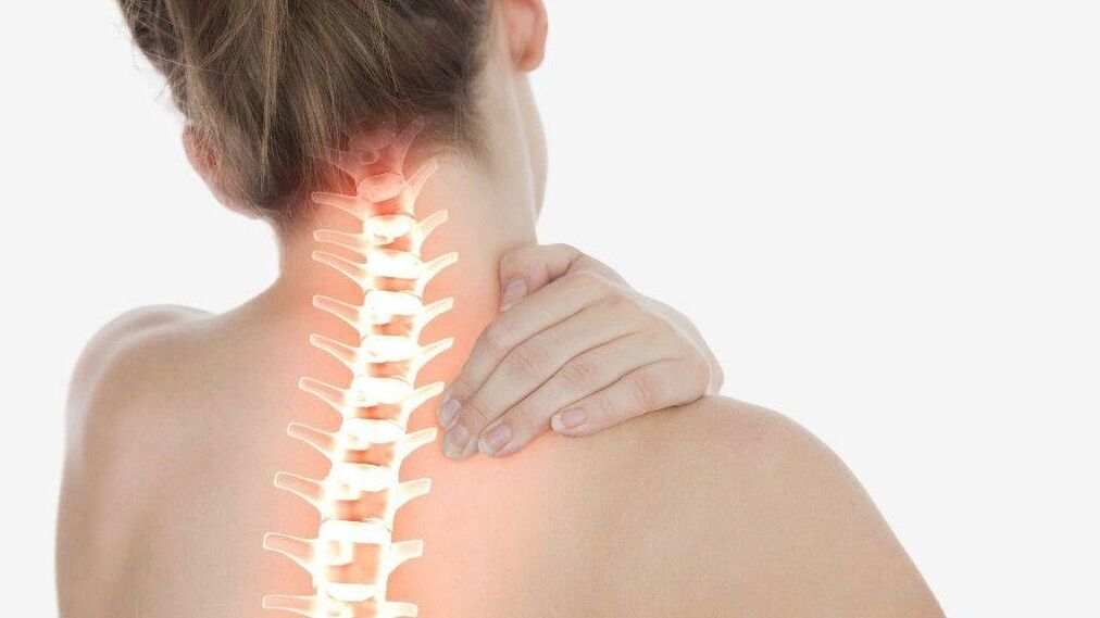 ด้วยโรคกระดูกพรุนของกระดูกสันหลังส่วนคออาจเกิดอาการ radicular ได้